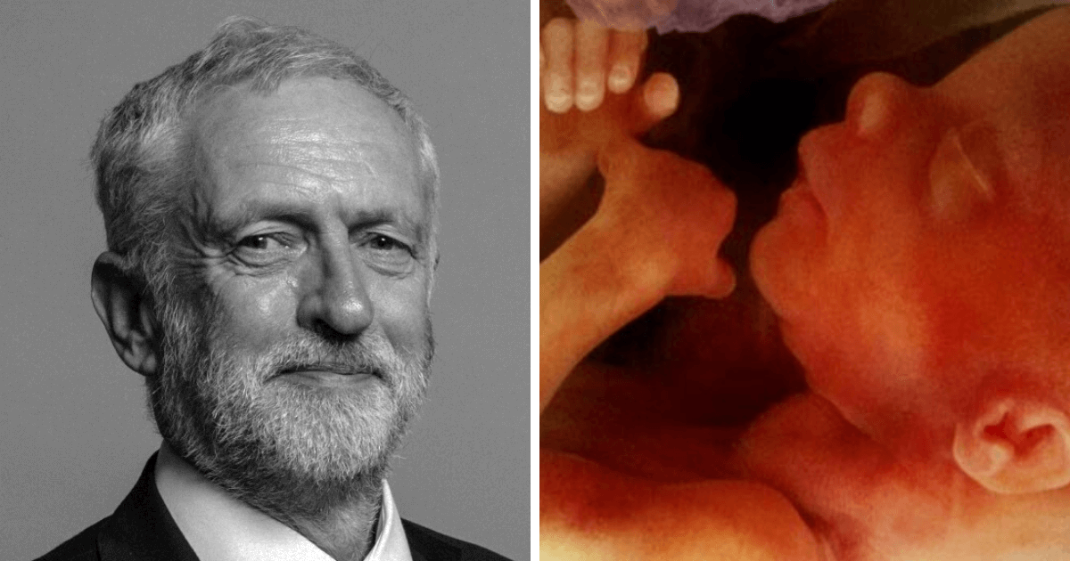 Labour abortion up to birth