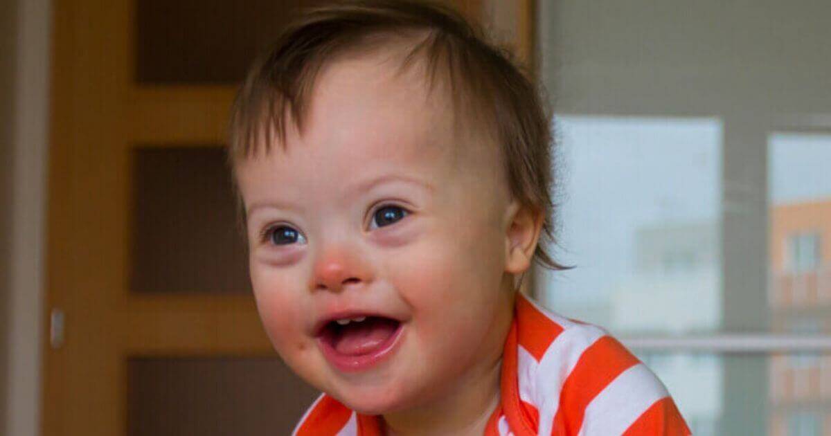 Downs syndrome abortion increase uk 1