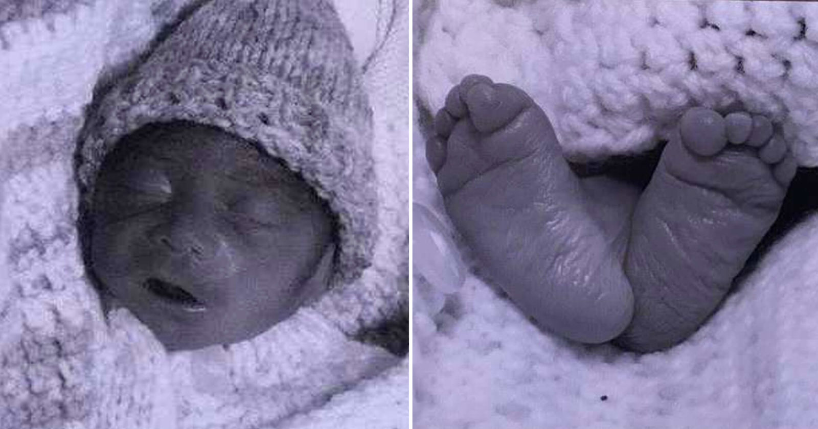 abortion baby born alive