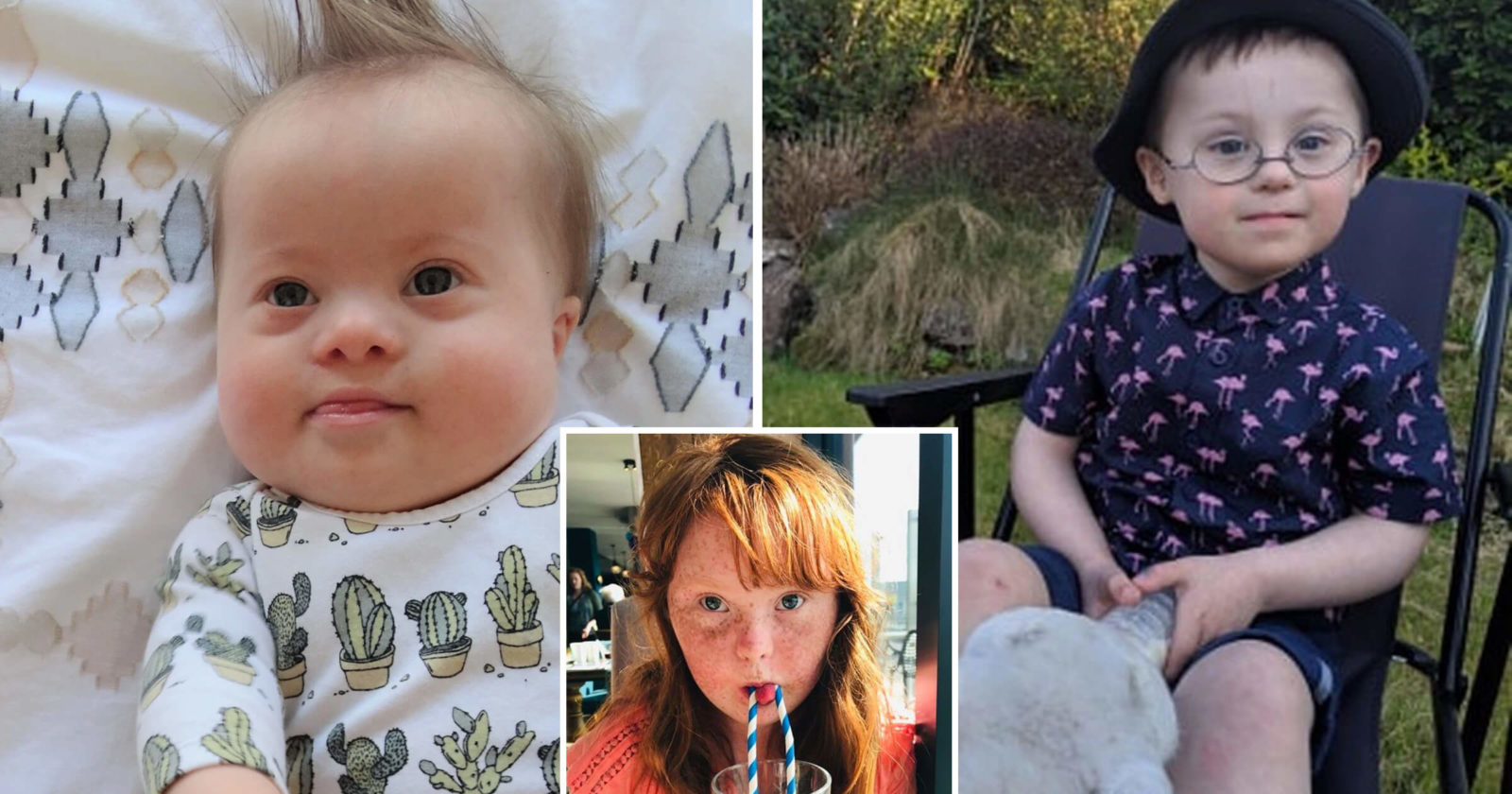 scottish mothers downs syndrome