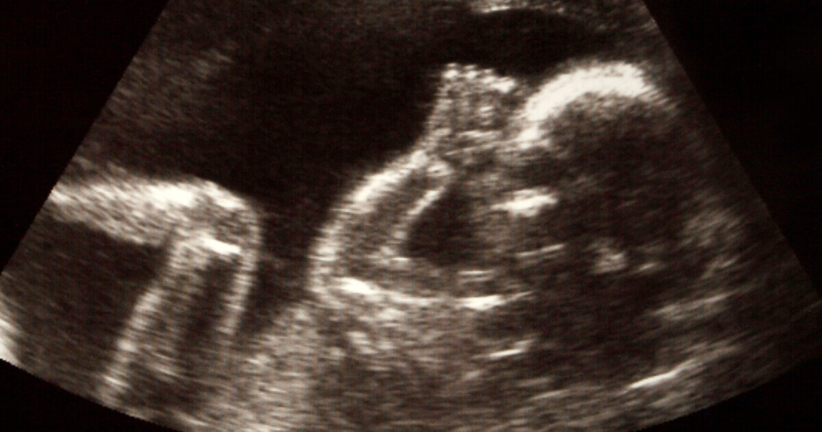 baby scan 1