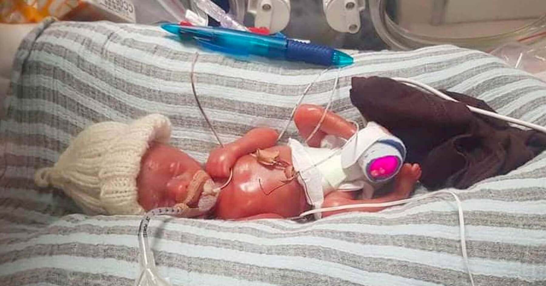 Baby born one week before UK abortion time limit leaves intensive care