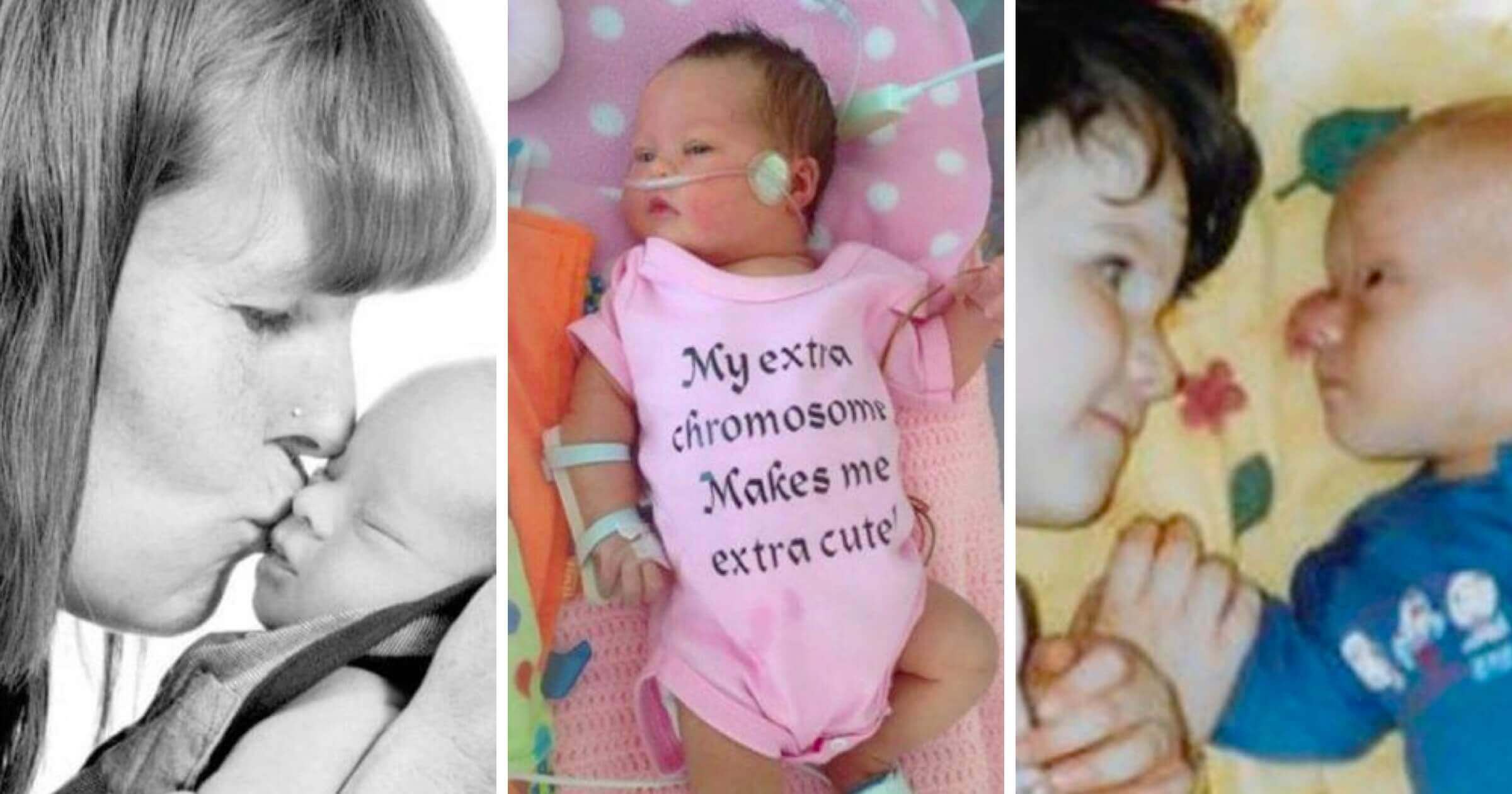 Pressured to abort because their baby had Down’s syndrome: three stories