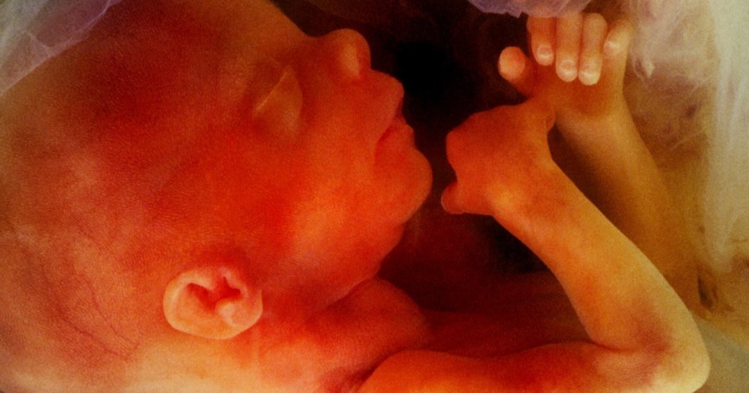Press release – Campaigners call for MPs to vote down abortion up to birth amendments, as polling shows two-thirds of women support amendment to reinstate in-person consultations