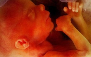Press release – Campaigners call for MPs to vote down abortion up to birth amendments, as polling shows two-thirds of women support amendment to reinstate in-person consultations