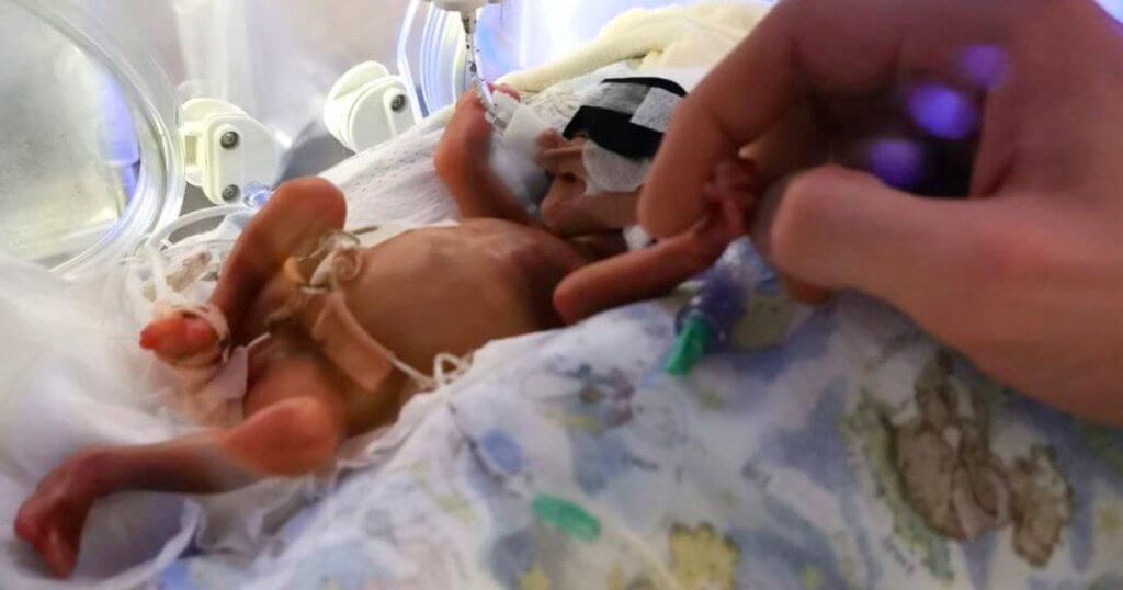 Baby born two weeks below abortion limit goes home after 4 months in hospital 2