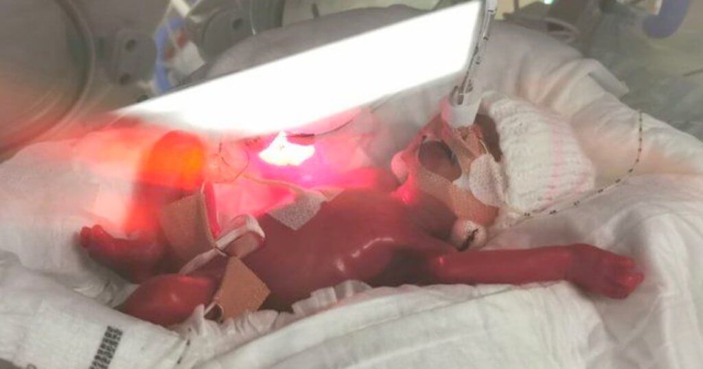 Baby born two weeks below abortion limit goes home after 4 months in hospital 4