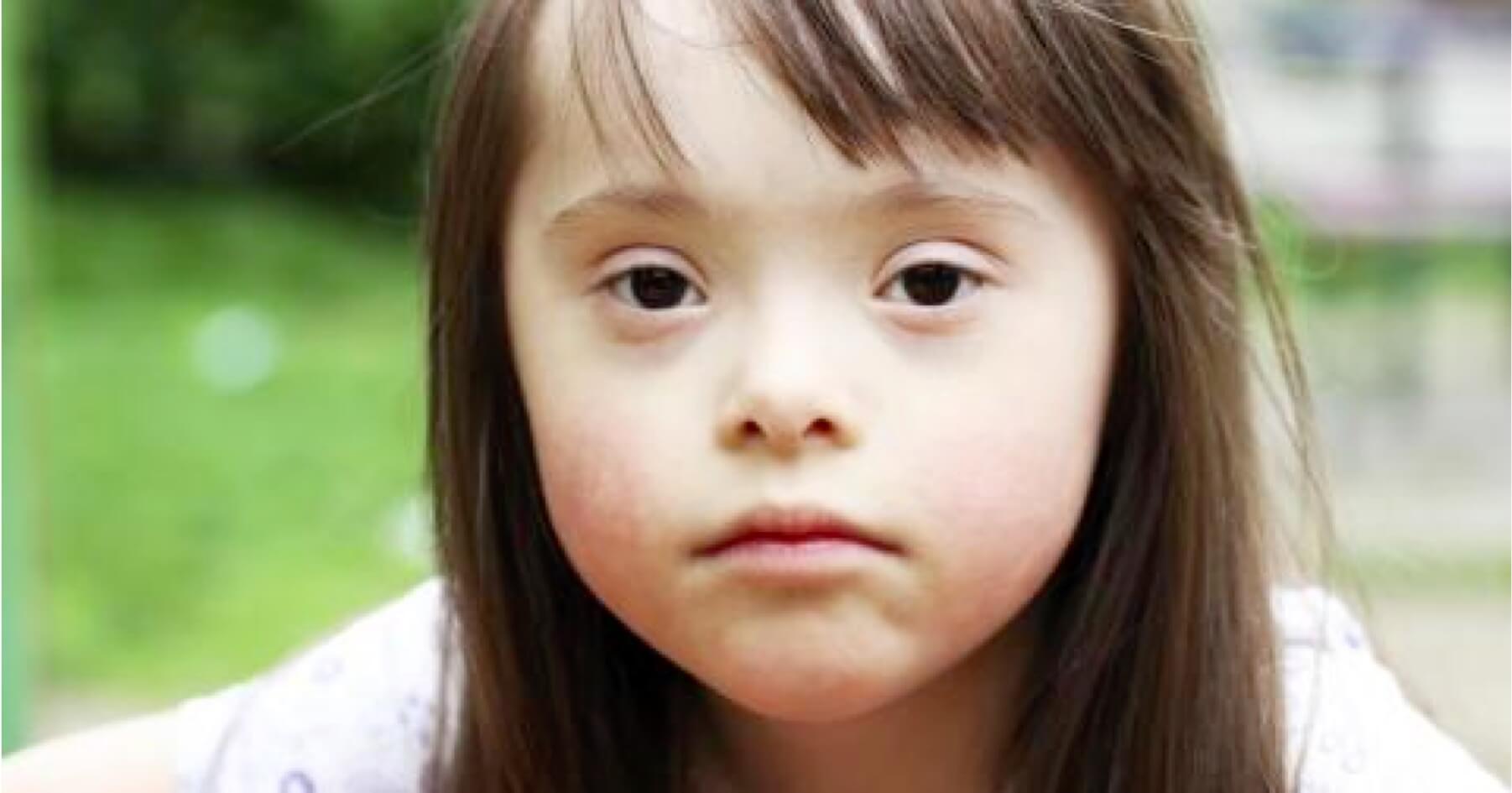 Govt going ahead with Down’s syndrome screening rollout despite likely increase in abortions