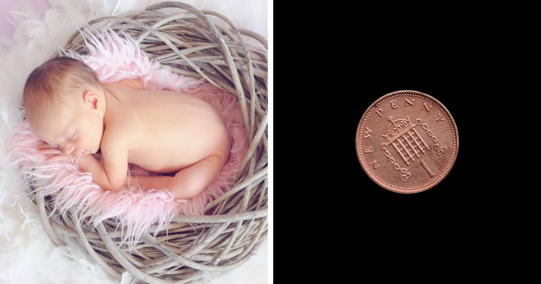 Girl born two days after abortion limit with feet size of penny now flourishing in primary school