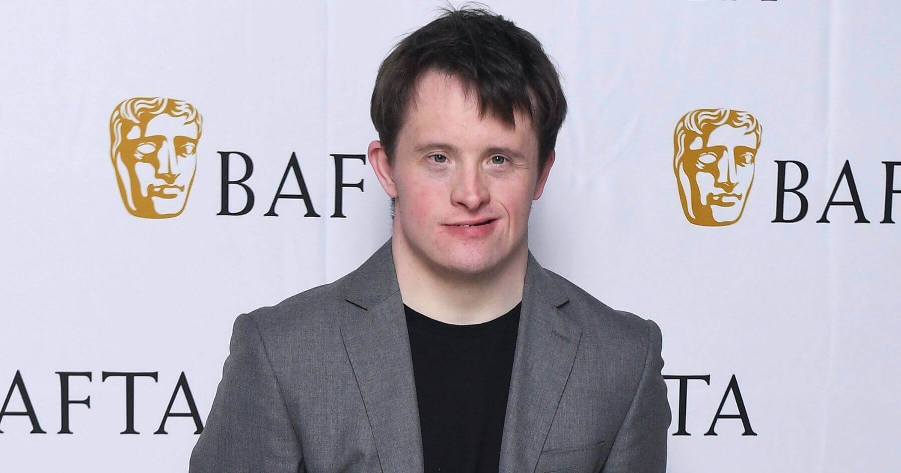 Mother of BBC’s Line of Duty star with Down's syndrome thankful she did not have pre-natal test