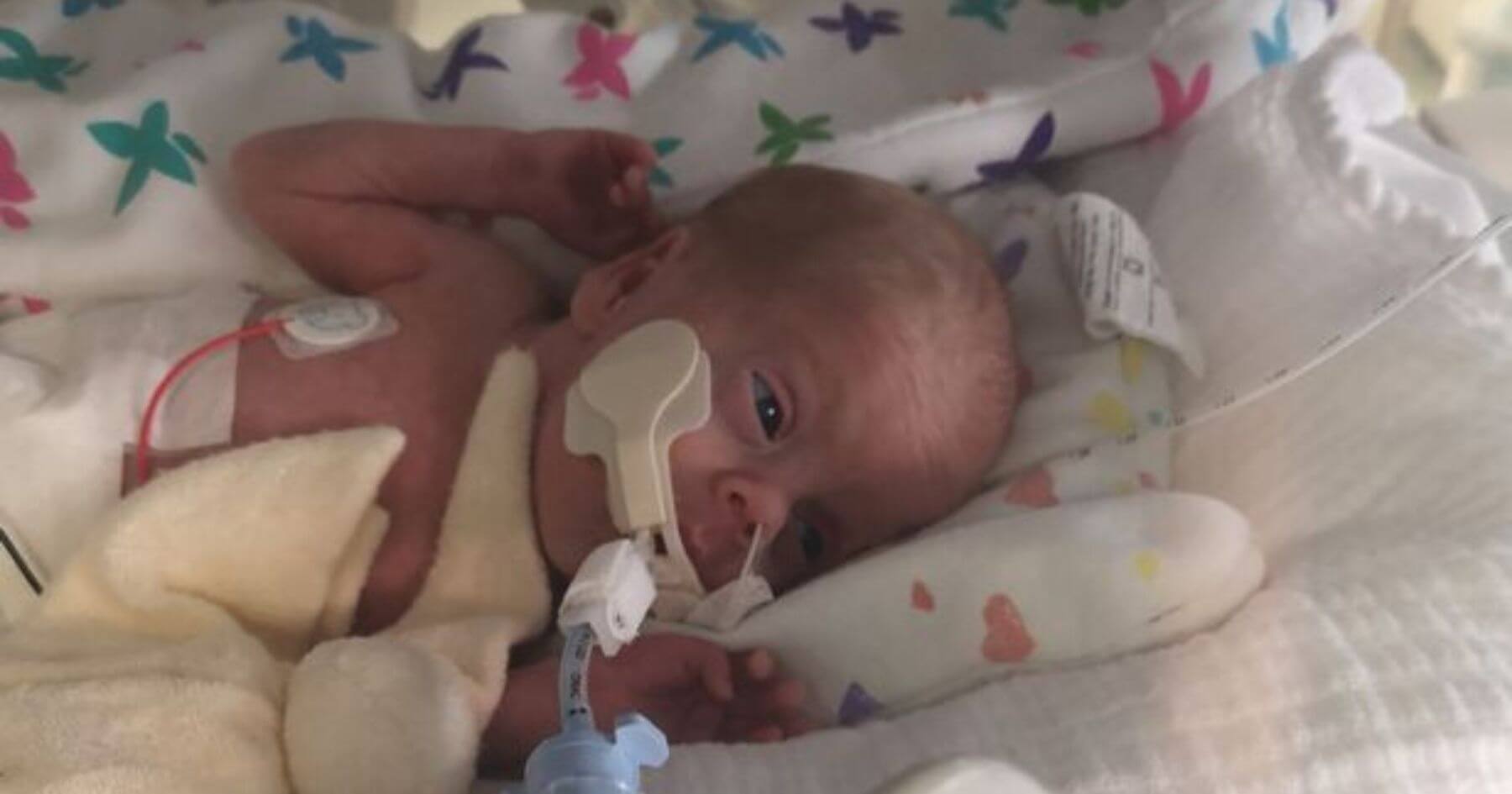 Baby born at 26 weeks with 50% chance of survival has just celebrated his first birthday
