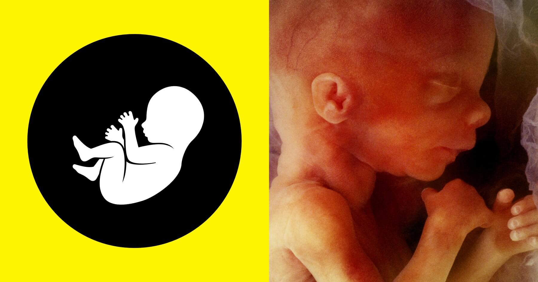 Ask your MP to stop abortion up to birth being introduced