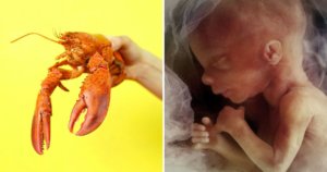 lobster unborn child