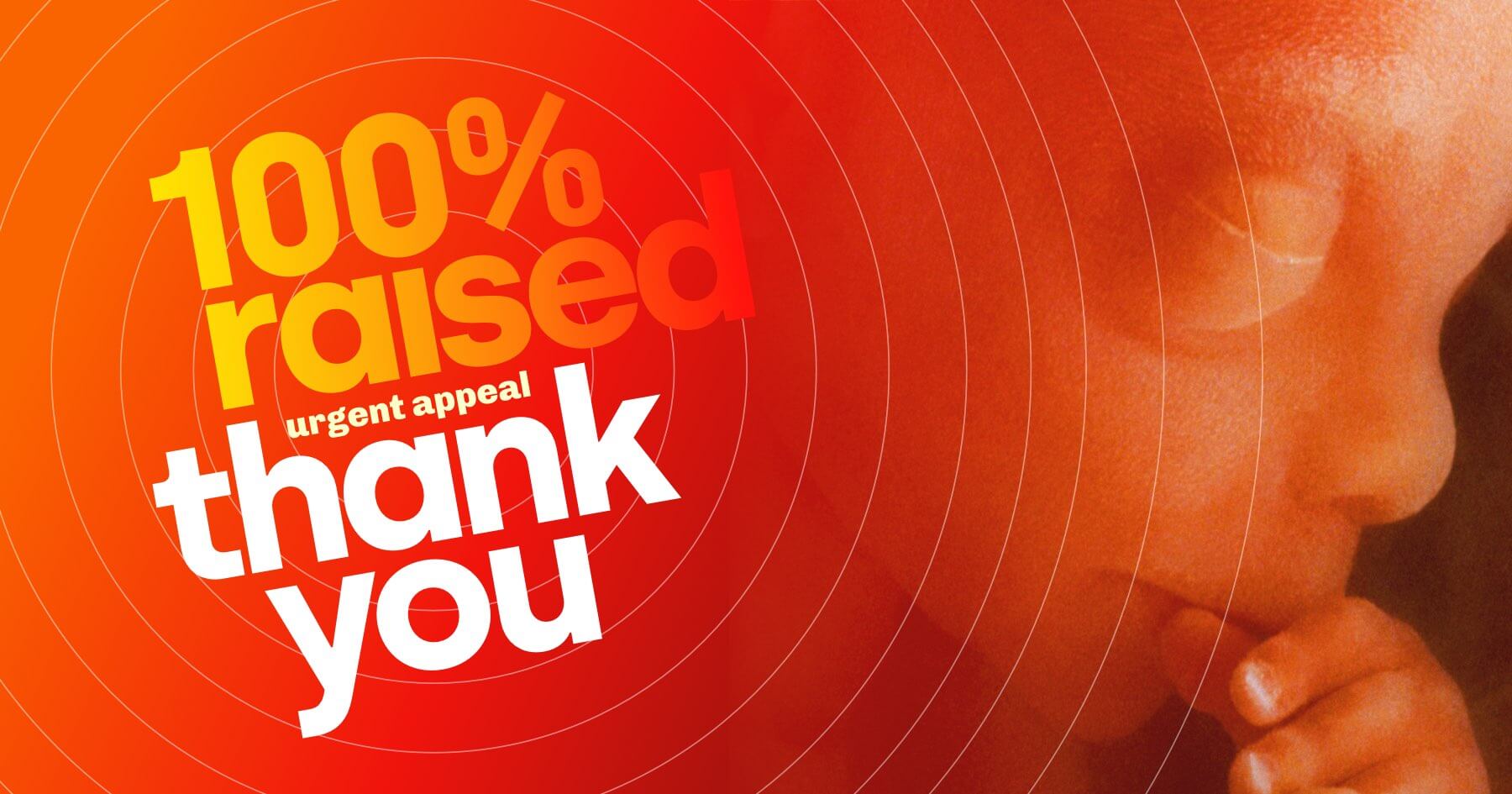 Thank you! 100 percent of our target has been raised