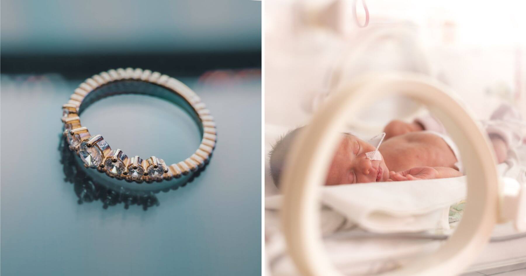 Tiny premature baby born so small she could wear her dad's wedding ring as a bracelet