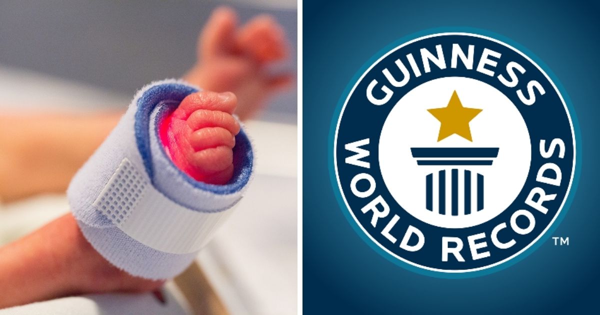 World's most premature baby born 3 weeks before UK abortion limit