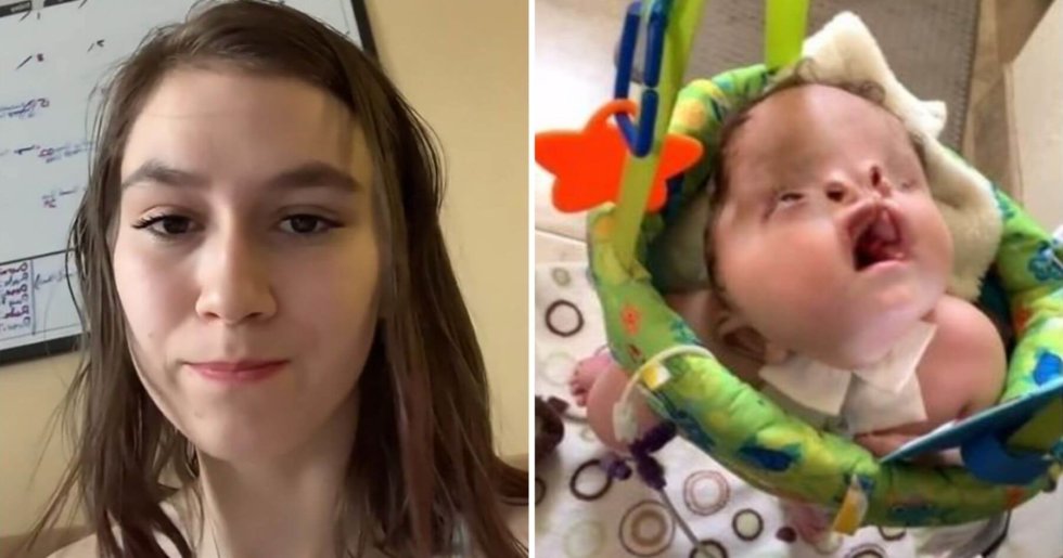 Mum Hits Back At Trolls Who Told Her To “put Down” Son Born With Disability