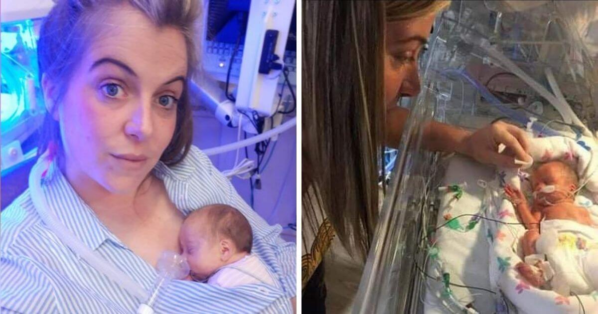 Mother battling sepsis gives birth to baby girl size of an iPhone