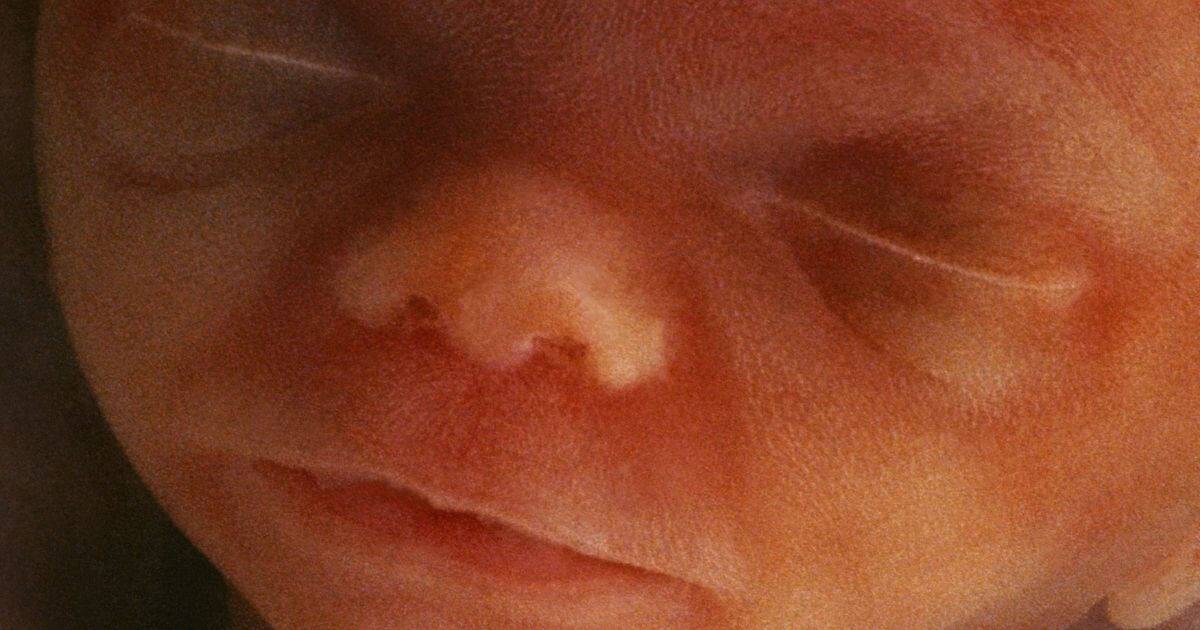 Artificial wombs raise challenging question for abortion supporters
