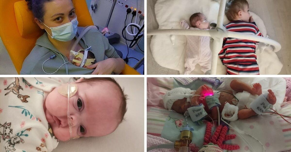 Baby Bonnie battles the odds and finally comes home after being born 17 weeks premature