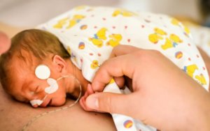 Premature babies surviving in neonatal units at ever-increasing rates