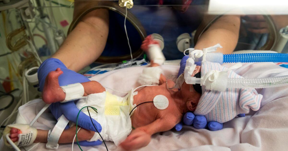 Baby born 101 days early kept alive by being wrapped in plastic bag
