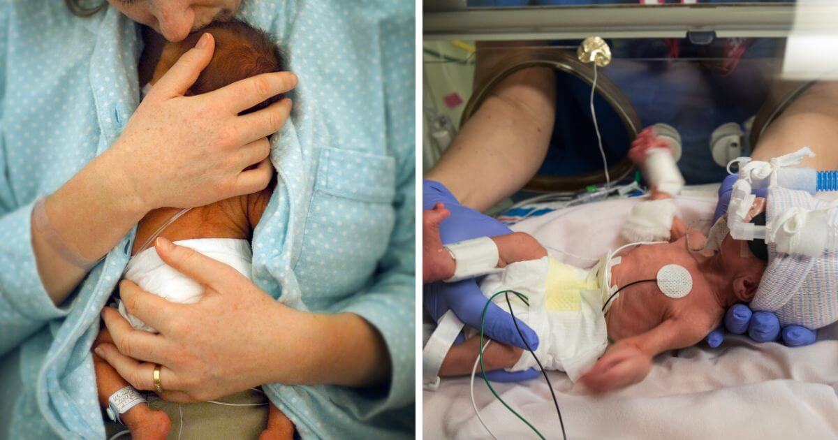 Premature baby born three days before UK abortion limit, saved by cuddles from her mum