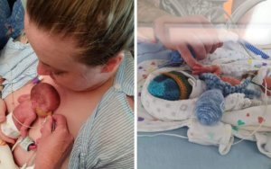 540g premature baby born at 27 weeks is now a thriving two year old