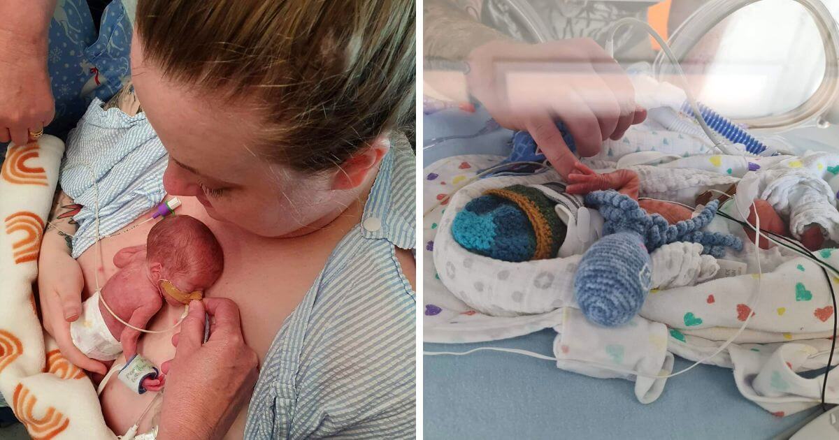 540g premature baby born at 27 weeks is now a thriving two year old