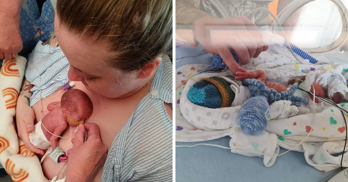 An Open Letter to Preemie Parents From a Micro Preemie Mom