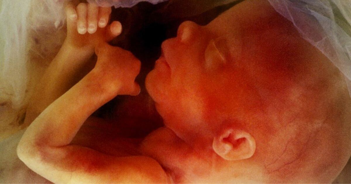 2022 – A year of significant pro-life victories