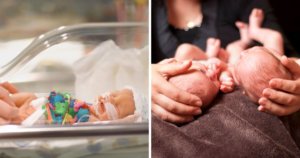 Mum refuses abortion of one of her twin daughters, nine months later, both twins are flourishing
