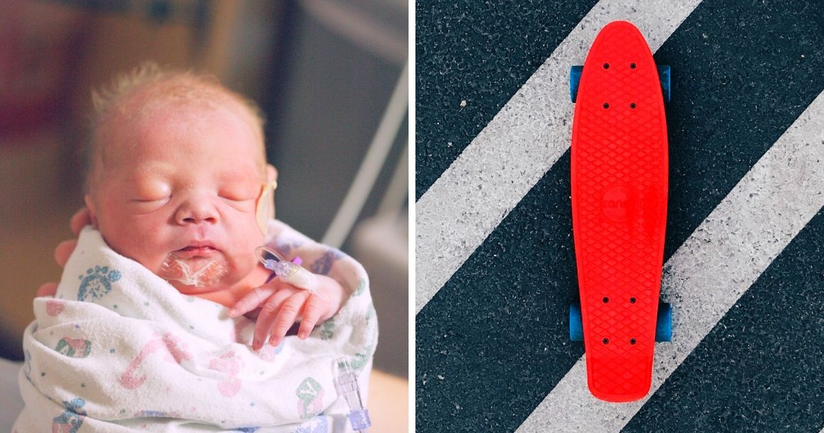 Researchers find skateboard for premature babies helps reduce delays in development