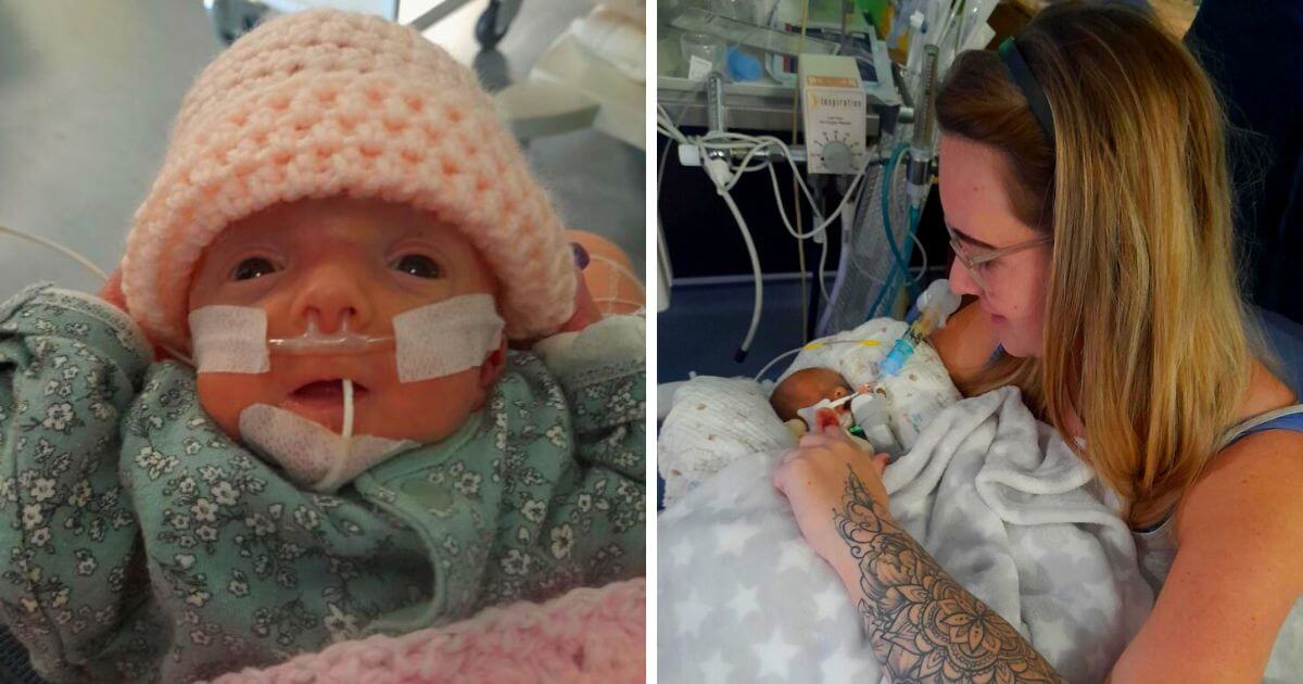 Born at 26 weeks and contracting sepsis, baby Aurora has defied the odds