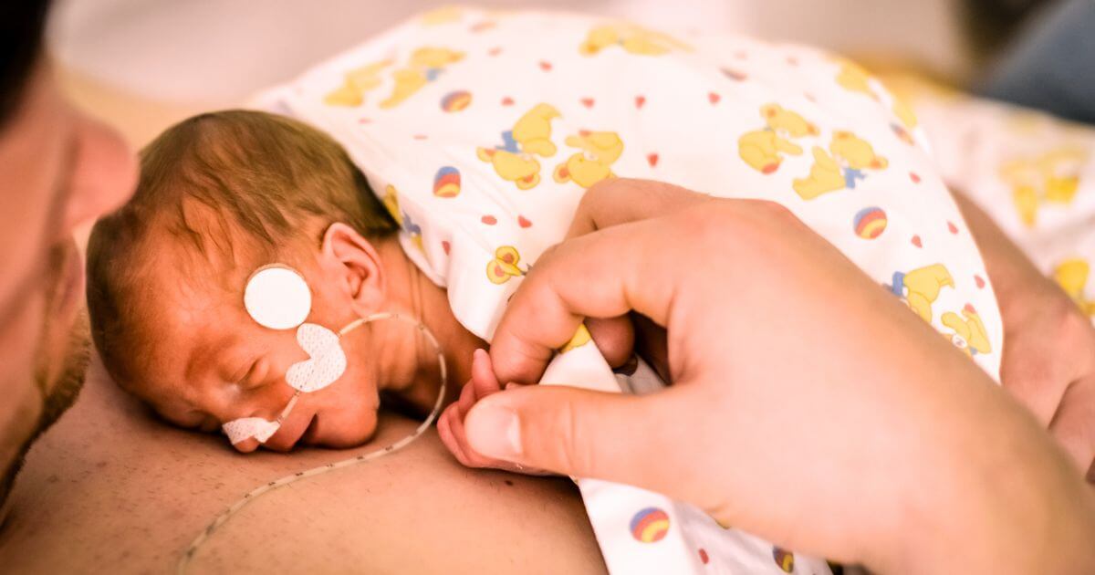 Kangaroo care the family therapy helping premature babies