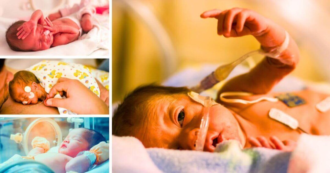 Right To Life News 56 Threefold increase in number of babies born at 22 weeks who survive