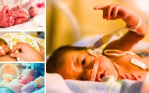 Threefold increase in number of babies born at 22 weeks who survive