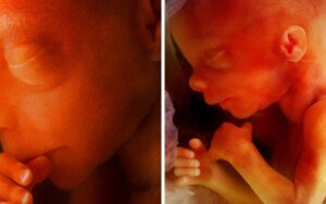 Action alert – Email your MP to stop abortion up to birth amendments