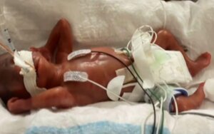 Baby born at 21 weeks weighing same as a can of coke discharged from hospital