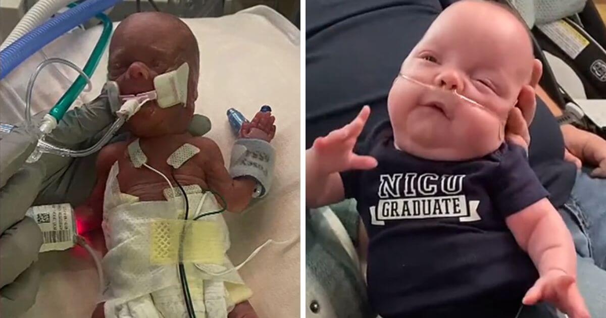 Baby born at 24 weeks is the smallest ever to survive at Nebraska hospital