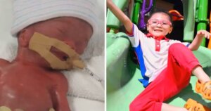 Baby girl born weighing just 510g at 22 weeks, now thriving at five years old