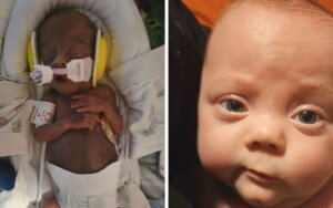 “Miracle” baby born weighing just 15 ounces now eight months old