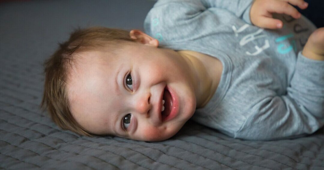 Nearly 90% of babies prenatally diagnosed with Down’s syndrome were aborted in 2021