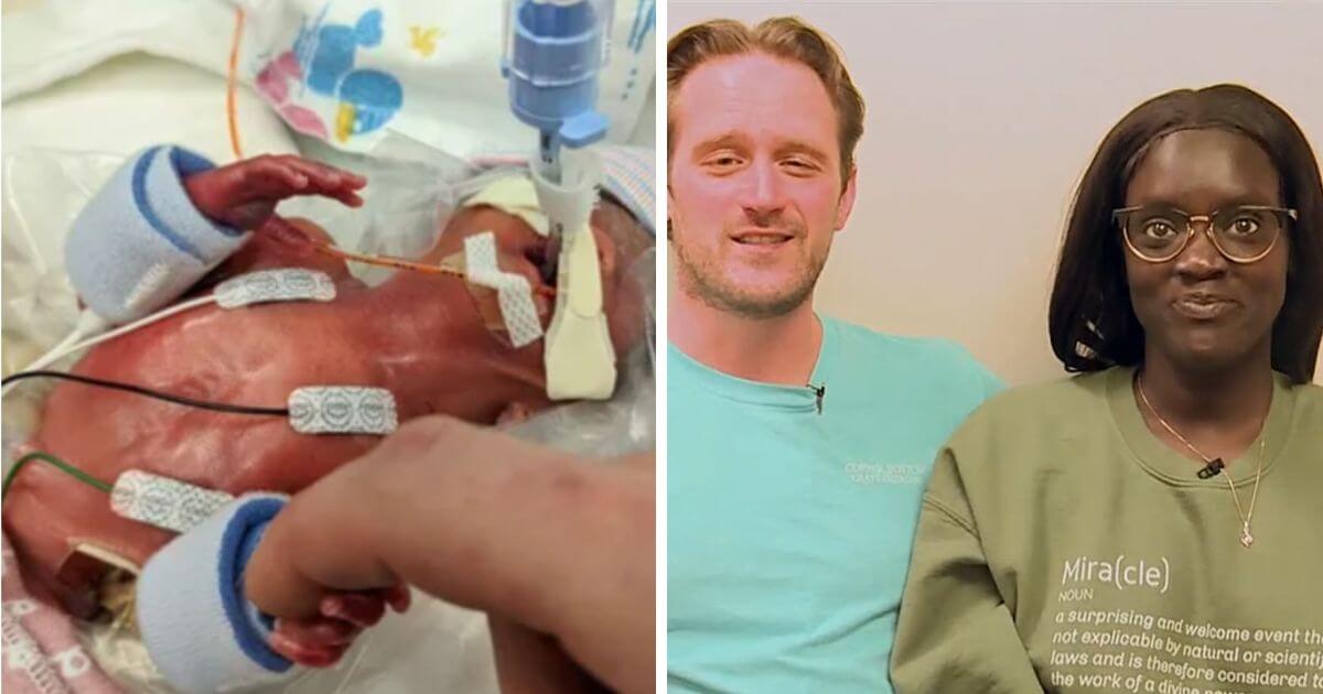 Premature baby girl born at just 22 weeks shows her “fighting spirit” to newlywed parents