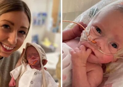 Baby born with 10 chance of survival preparing to leave hospital