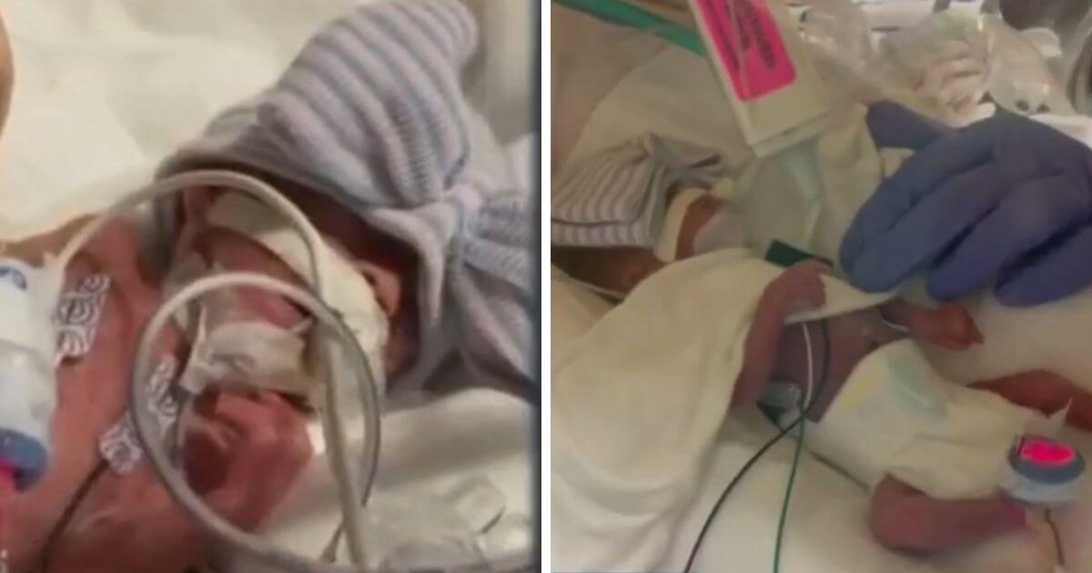 “Miracle baby” born the size of a coke can survives all odds to thrive at one year