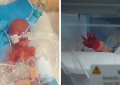 Premature baby girl wrapped in a sandwich bag at birth enjoys first birthday celebrations in hospital