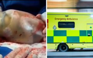 Emergency responders awarded commendations for saving baby born at 26 weeks still in his amniotic sac
