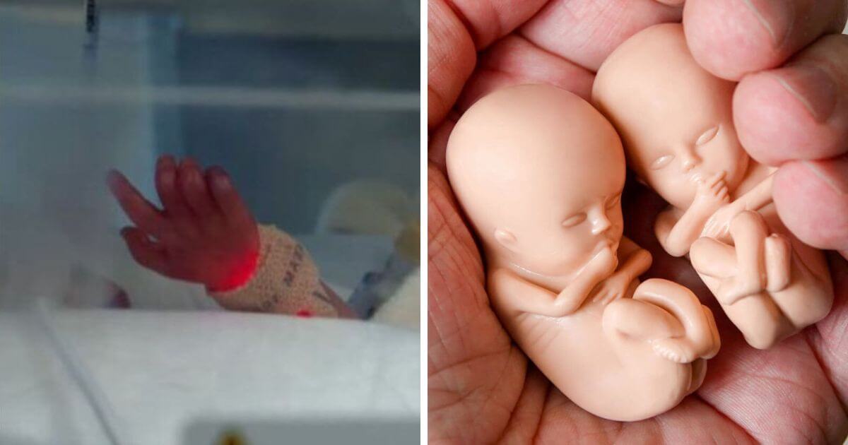 Manchester mother shares story of giving birth to preemie babies 22 days apart from each other