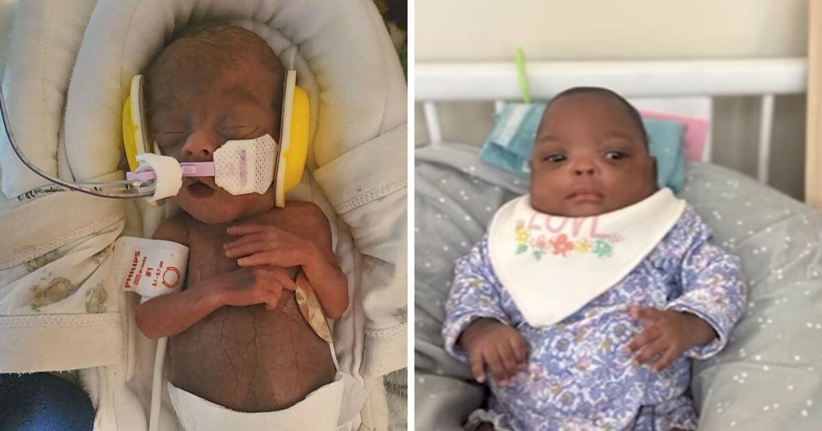 Baby born at 24 weeks the size of a doll goes home after 6 months
